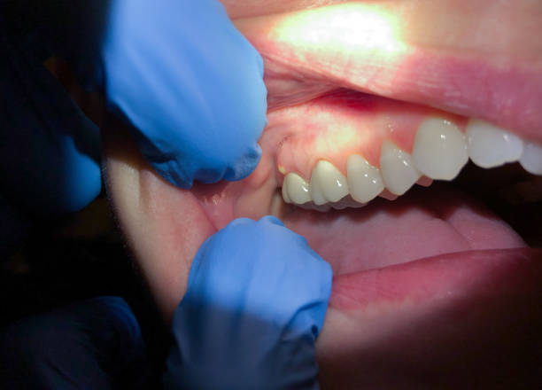 Best Broken Tooth Emergency  in Wendover, UT